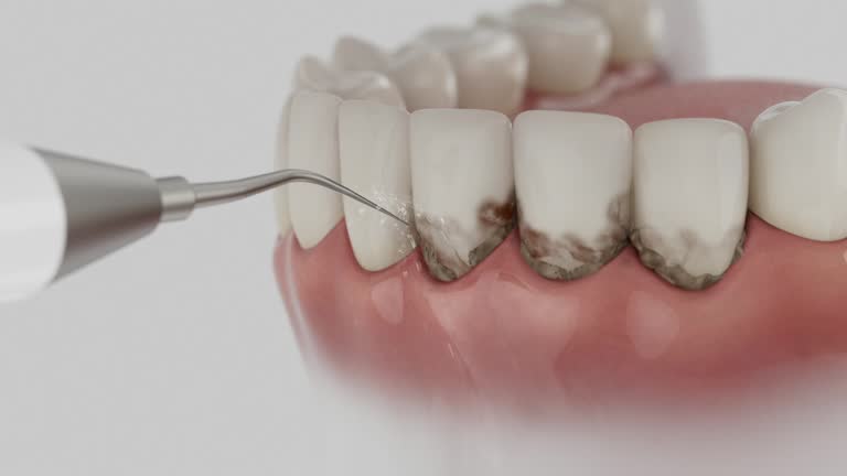 Reliable Dental contractor in Hines, OR by Smile Center Dentistry